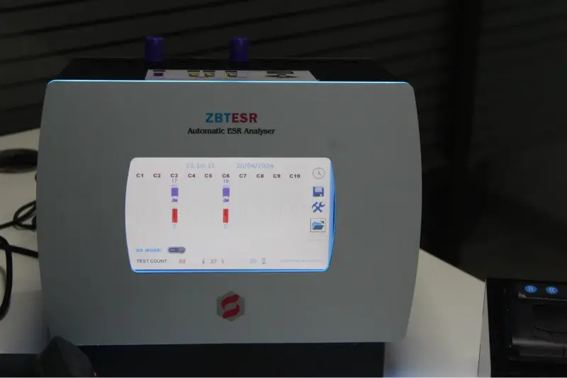 fully automatic biochemistry analyzer